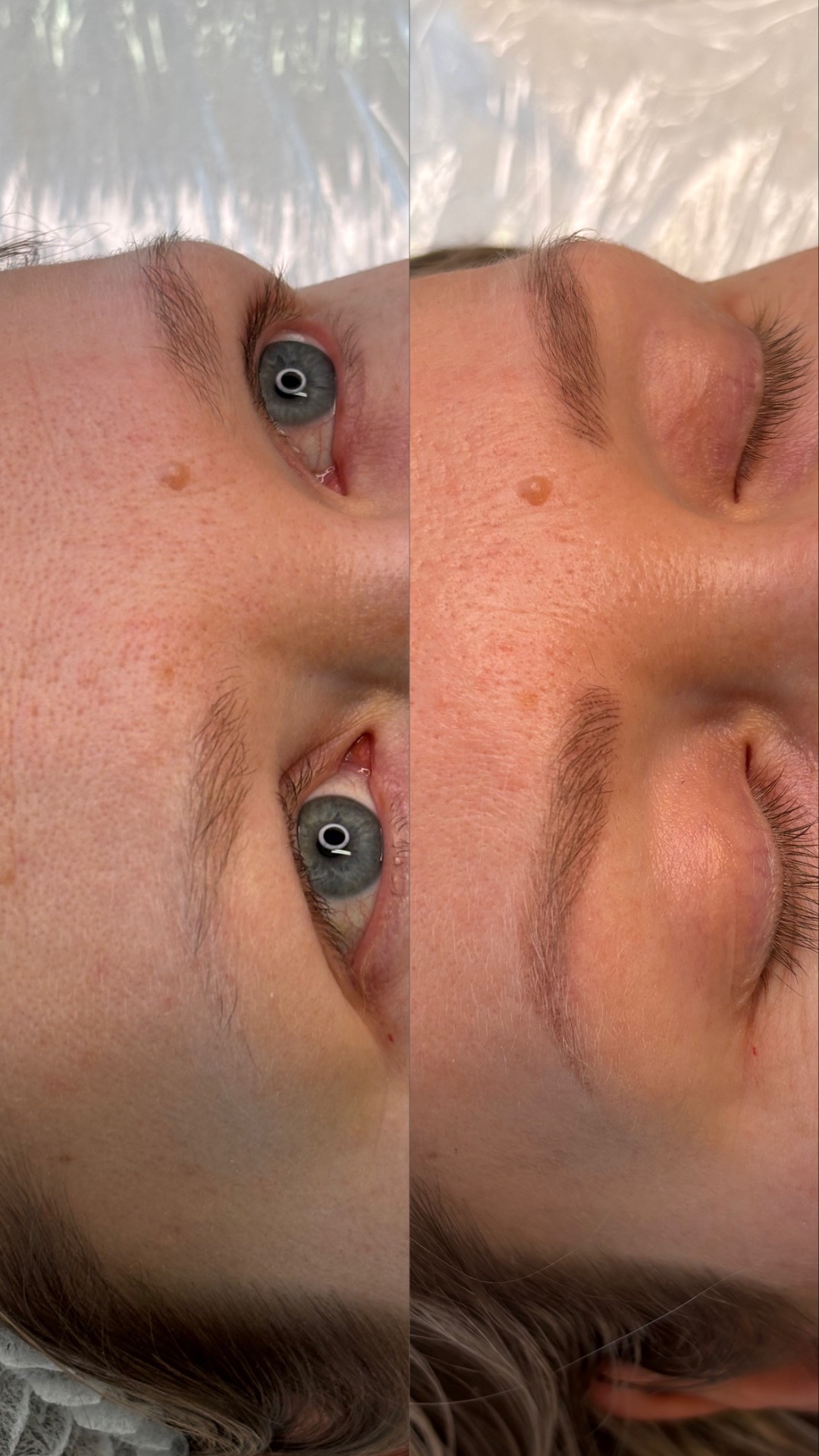 Ennen ja jälkeen. Parantuneet kulmat ennen vahvistusta